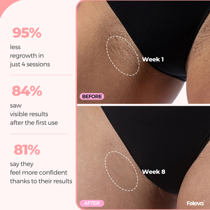 LumiPro® IPL Hair Removal