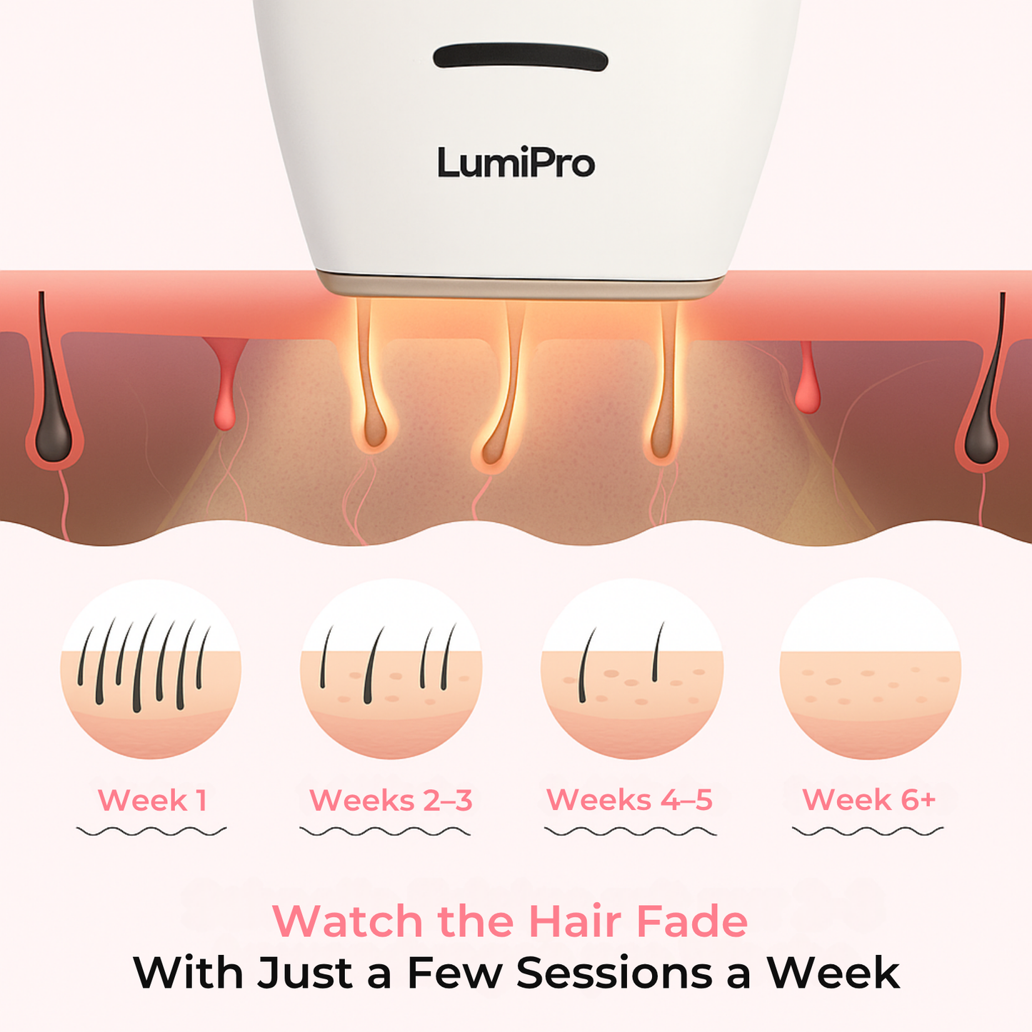 LumiPro® IPL Hair Removal